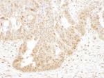 PSMB4 Polyclonal Antibody