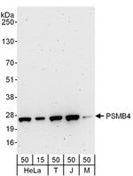 PSMB4 Antibody in Western Blot (WB)