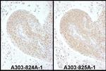 PSMC6 Polyclonal Antibody