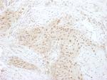 PSMD7 Polyclonal Antibody
