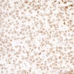 H2AX Antibody in Immunohistochemistry (Paraffin) (IHC (P))