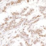 H2AX Antibody in Immunohistochemistry (Paraffin) (IHC (P))