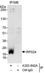 RPS24 Antibody in Immunoprecipitation (IP)