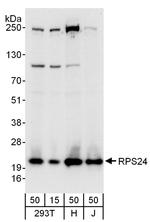 RPS24 Polyclonal Antibody