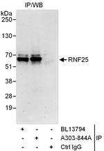 RNF25 Antibody in Immunoprecipitation (IP)