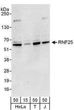 RNF25 Antibody in Western Blot (WB)