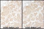 PSMA1 Polyclonal Antibody