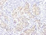 PSMB5 Polyclonal Antibody