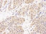 PSMB7 Antibody in Immunohistochemistry (Paraffin) (IHC (P))