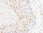 PSMB7 Polyclonal Antibody