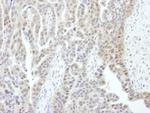 PSMD1 Polyclonal Antibody