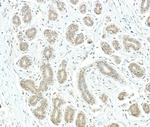PSMD1 Polyclonal Antibody