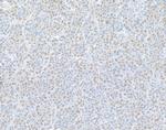 PSMD1 Antibody in Immunohistochemistry (Paraffin) (IHC (P))