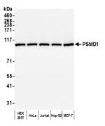 PSMD1 Antibody in Western Blot (WB)