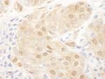 PSMD2 Antibody in Immunohistochemistry (Paraffin) (IHC (P))