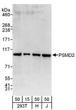 PSMD2 Antibody in Western Blot (WB)