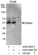 PSMD4 Antibody in Immunoprecipitation (IP)