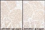 PSMD4 Polyclonal Antibody