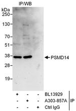 PSMD14 Antibody in Immunoprecipitation (IP)