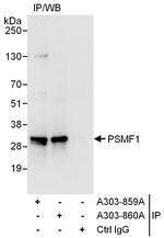 PSMF1 Antibody in Immunoprecipitation (IP)