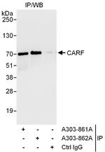 CARF Antibody in Immunoprecipitation (IP)