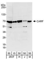 CARF Polyclonal Antibody