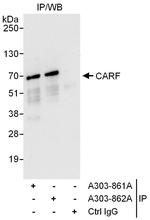 CARF Antibody in Immunoprecipitation (IP)