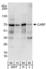 CARF Polyclonal Antibody