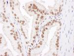 Cul4B Polyclonal Antibody