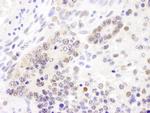 Cul4B Antibody in Immunohistochemistry (Paraffin) (IHC (P))
