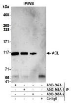 ACL Antibody in Immunoprecipitation (IP)