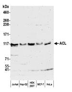 ACL Polyclonal Antibody