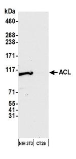 ACL Antibody in Western Blot (WB)