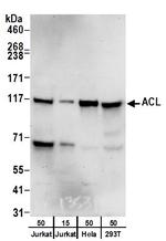 ACL Polyclonal Antibody