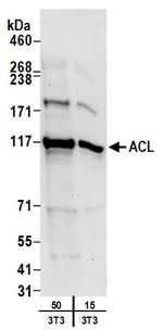 ACL Antibody in Western Blot (WB)