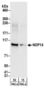 NOP14 Polyclonal Antibody