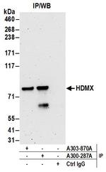 HdmX/MDM4 Polyclonal Antibody
