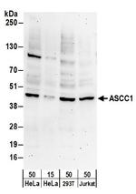 ASCC1 Polyclonal Antibody