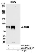 CD44 Antibody in Immunoprecipitation (IP)