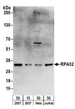 RPA32 Antibody in Western Blot (WB)