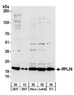 RPL26 Polyclonal Antibody