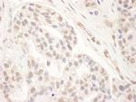 MED1 Polyclonal Antibody