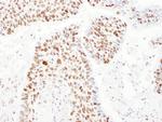 PSME3 Antibody in Immunohistochemistry (Paraffin) (IHC (P))