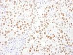 PSME3 Antibody in Immunohistochemistry (Paraffin) (IHC (P))