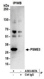 PSME3 Antibody in Immunoprecipitation (IP)