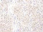PSME4 Antibody in Immunohistochemistry (Paraffin) (IHC (P))