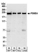 PSME4 Antibody in Western Blot (WB)