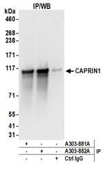 CAPRIN1 Antibody in Immunoprecipitation (IP)