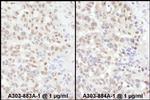 ADAR1 Polyclonal Antibody