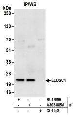 EXOSC1 Antibody in Immunoprecipitation (IP)